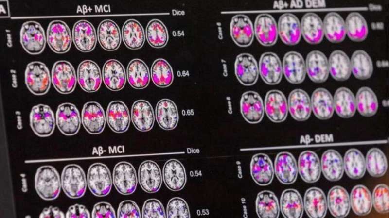 【技术深度】pTau217血液标志物:阿尔茨海默病早筛的精准革命与现实困境 新闻